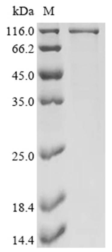 c-Myc Protein, Human, Recombinant (Avi & His & MBP), Biotinylated
