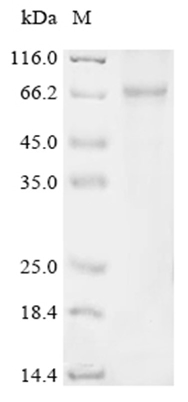 ABAT Protein, Human, Recombinant (His & Myc & SUMO)