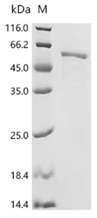 VPS4A Protein, Human, Recombinant (His & Myc)