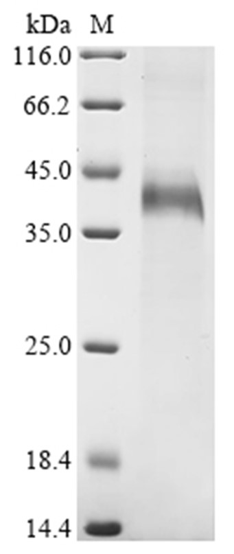 Wnt5a Protein, Human, Recombinant (His)