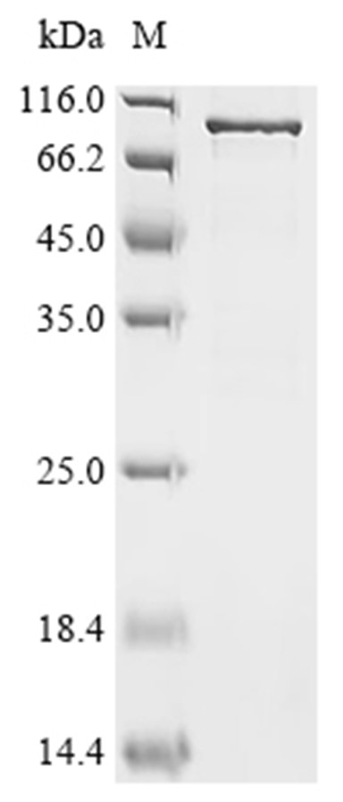 DDX3X Protein, Human, Recombinant (B2M & His)