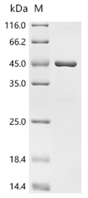 TEAD4 Protein, Human, Recombinant (His)