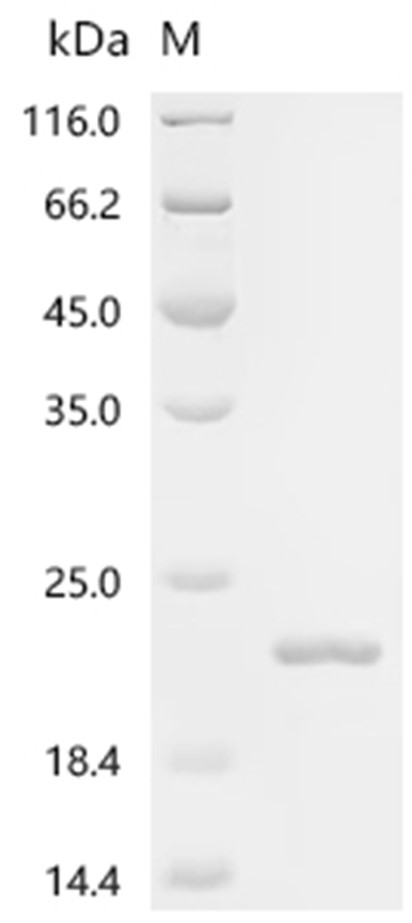 FHIT Protein, Mouse, Recombinant (His)