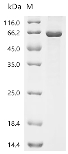 HDAC3 Protein, Human, Recombinant (His & SUMO)
