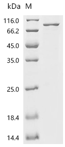 2-5A-dependent Rnase Protein, Human, Recombinant (Myc)