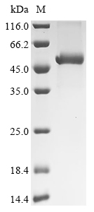 Jagged 1 Protein, Mouse, Recombinant (His & Myc & SUMO)