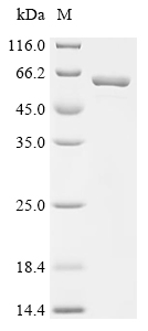 TPM3 Protein, Human, Recombinant (GST)