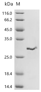 ssPB Protein, E. coli O157:H7, Recombinant (His)