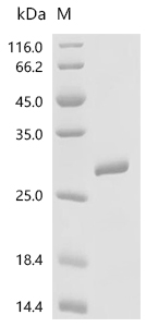 Titin Protein, Human, Recombinant (Isoform 6, His)