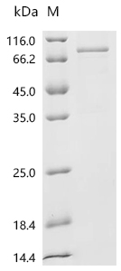 DDX3Y Protein, Human, Recombinant (His & Myc)