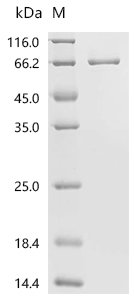 MAPK14 Protein, Human, Recombinant (His & GST)