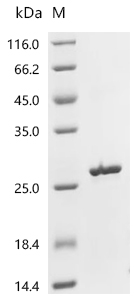ANGPTL8 Protein, Mouse, Recombinant (E. coli, His)