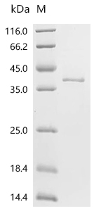 HSD17B13 Protein, Mouse, Recombinant (His & Myc)