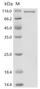 PTK7/CCK4 Protein, Human, Recombinant (Active, His)