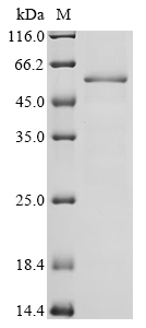 CYP2E1 Protein, Mouse, Recombinant (His)