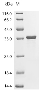 CDK1 Protein, Human, Recombinant (His)