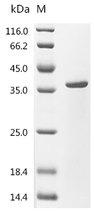 FPR1 Protein, Mouse, Recombinant (GST & His & Myc)