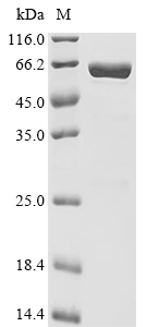 RIPK3 Protein, Human, Recombinant (His)