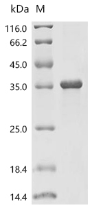 SPSB1 Protein, Human, Recombinant (His)