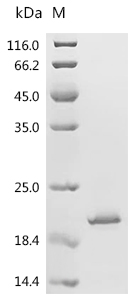 SAA2 Protein, Mouse, Recombinant (His)