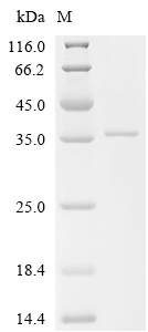 CYBB Protein, Human, Recombinant (His)