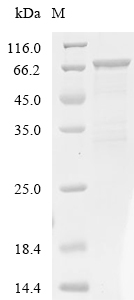 SIRT6 Protein, Human, Recombinant (GST)