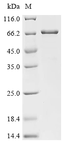 IKZF1 Protein, Human, Recombinant (Avi & His)
