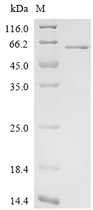 MMP-13 Protein, Human, Recombinant (His & SUMO)