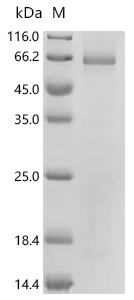NOX4 Protein, Human, Recombinant (Cell-Free, His)