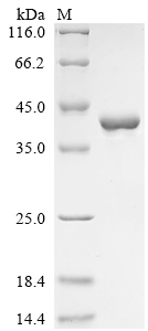 QPCT Protein, Mouse, Recombinant (His & Myc)