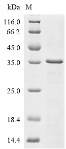 Coagulation factor V Protein, Human, Recombinant (His & SUMO)