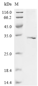 Myocilin Protein, Mouse, Recombinant (His & Myc)