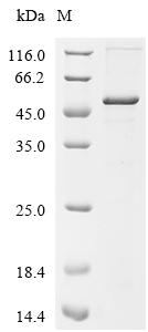 KLHDC3 Protein, Human, Recombinant (E. coli, His & Myc)