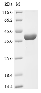 IFI35 Protein, Mouse, Recombinant (His)