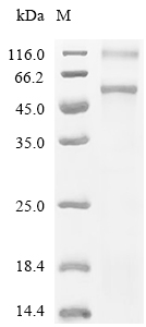 SLC7A11 Protein, Human, Recombinant (His)