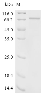 PLBL2/PLBD2 Protein, Rat, Recombinant (His & SUMO)