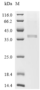 GAPDH Protein, Human, Recombinant (HEK293, His)