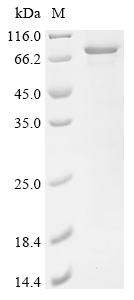 Perforin-1/PRF1 Protein, Human, Recombinant (His & SUMO)