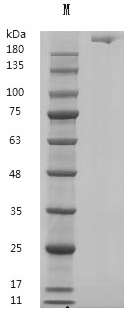 Fibronectin Protein, Human, Recombinant (aa 32-1908, His)