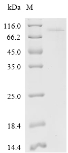 FXR1 Protein, Human, Recombinant (His)