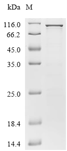 HSP90AB1 Protein, Human, Recombinant (His & Myc)