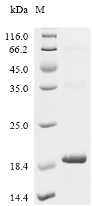 RNASE2 Protein, Human, Recombinant (His)