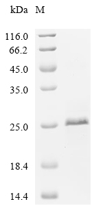 Metallothionein-3/MT3 Protein, Human, Recombinant (His & SUMO)