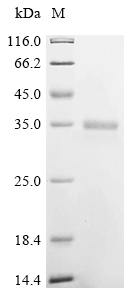 IGF1/IGF-I Protein, Chicken, Recombinant (hFc)