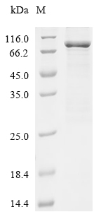 PNPLA2 Protein, Human, Recombinant (His & SUMO)
