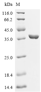 Microbial collagenase Protein, Clostridium perfringens, Recombinant (His & Myc)