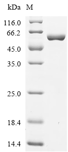 ALDH1A1 Protein, Mouse, Recombinant (E. coli, His)