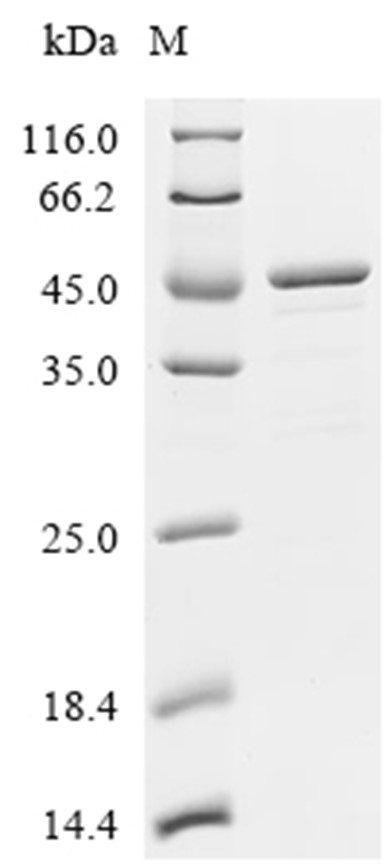 ACAT1 Protein, Human, Recombinant (His & Myc)