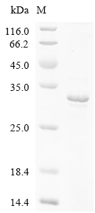 HLA-DRA Protein, Human, Recombinant (His)
