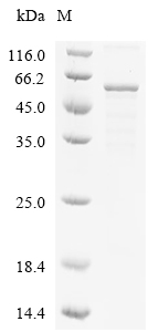 TPH2 Protein, Human, Recombinant (His)
